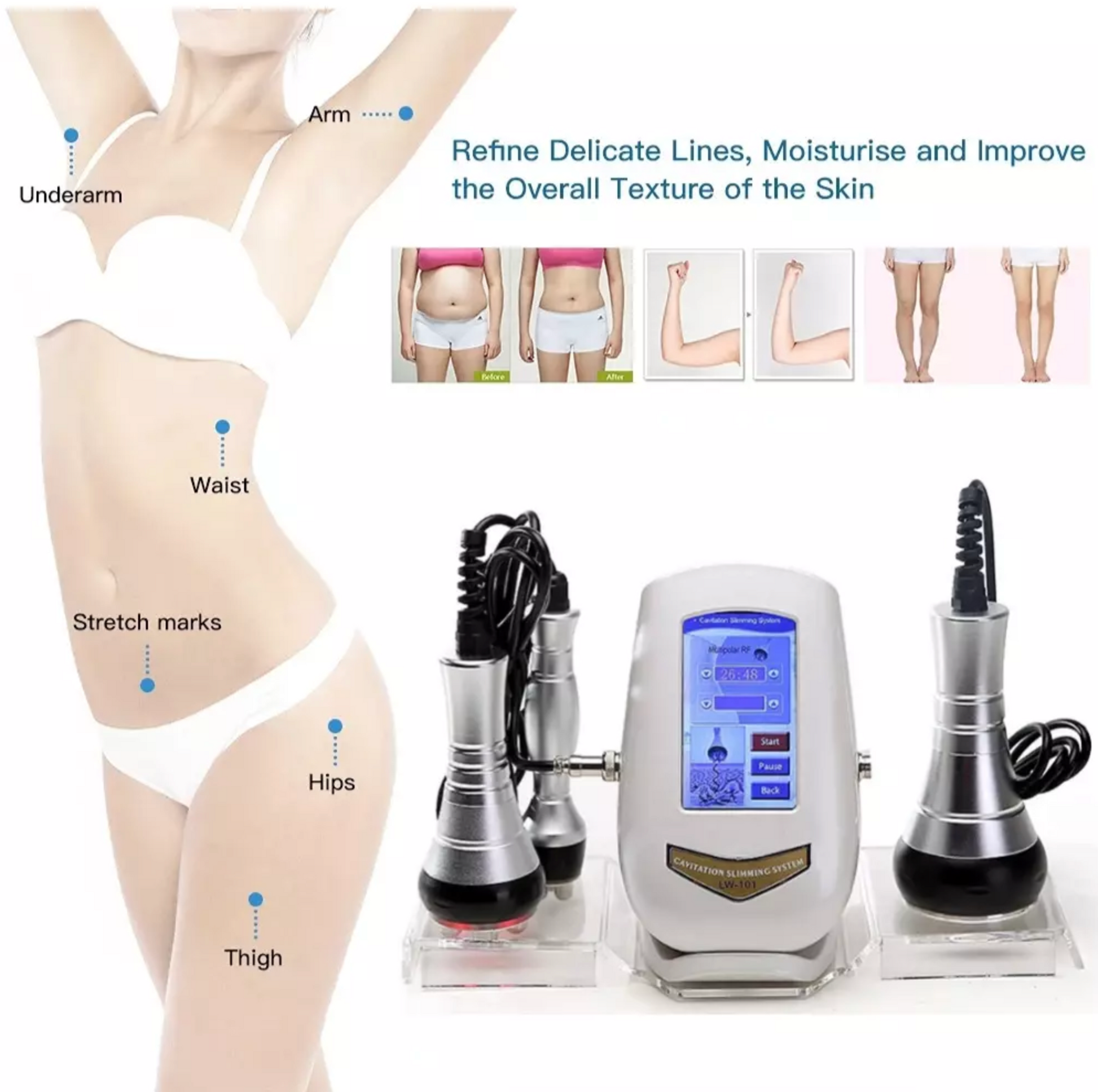 40K Cavitation & RF Fat Reduction Machine - aussie-deals4u
