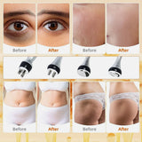 40K Cavitation & RF Fat Reduction Machine - aussie-deals4u