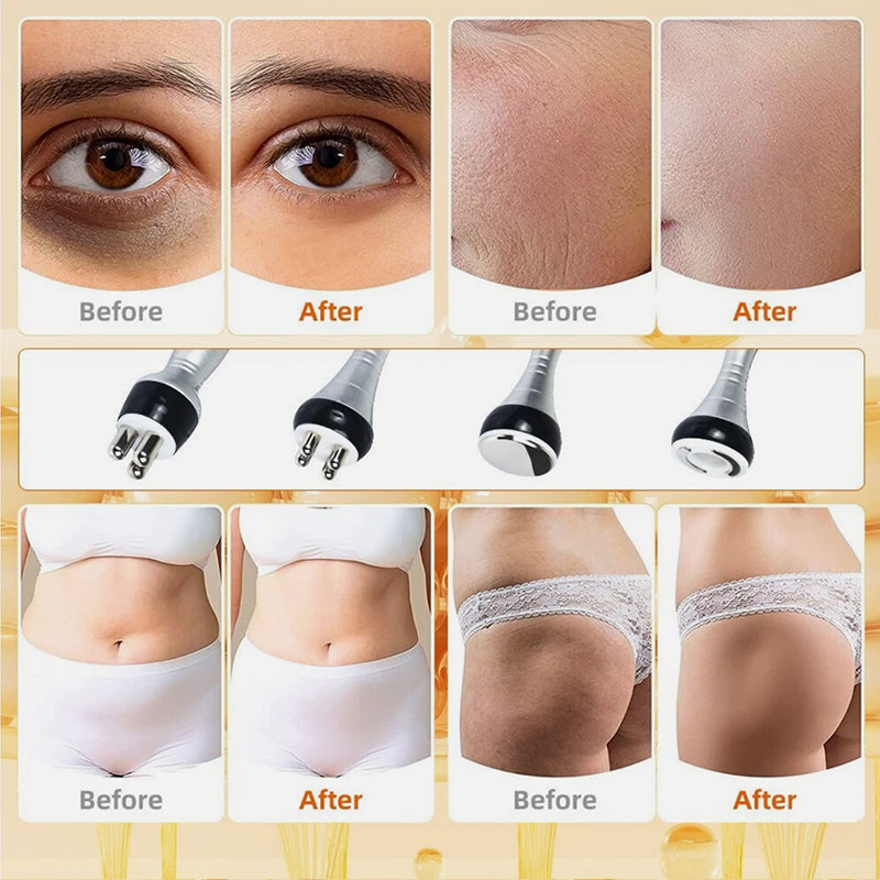 40K Cavitation & RF Fat Reduction Machine - aussie-deals4u