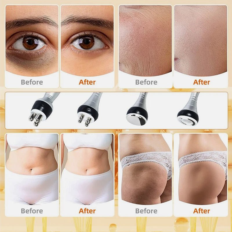 40K Cavitation & RF Fat Reduction Machine