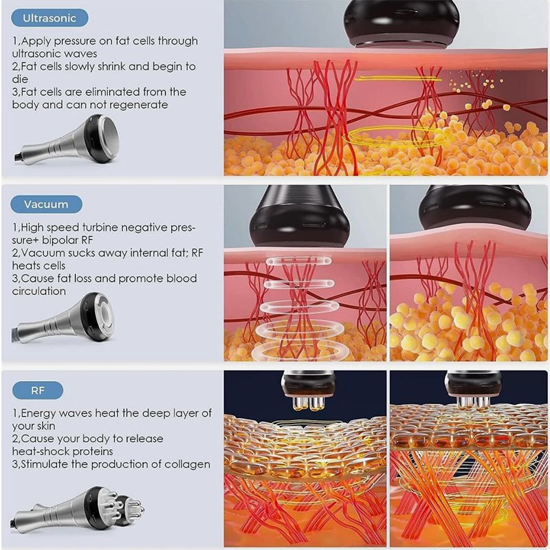 40K Cavitation & RF Fat Reduction Machine