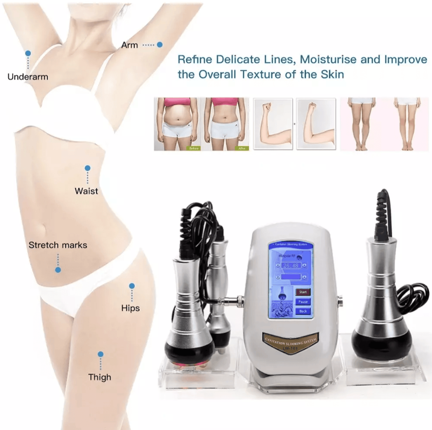 40K Cavitation & RF Fat Reduction Machine