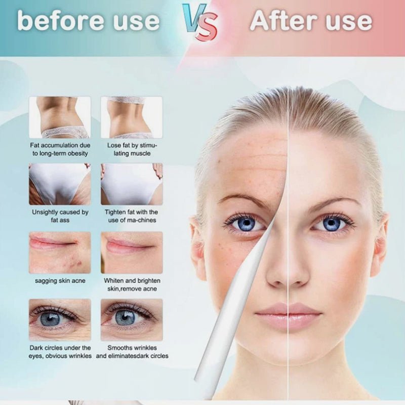 9 - in - 1 Multifunction Beauty Machine - aussie - deals4u